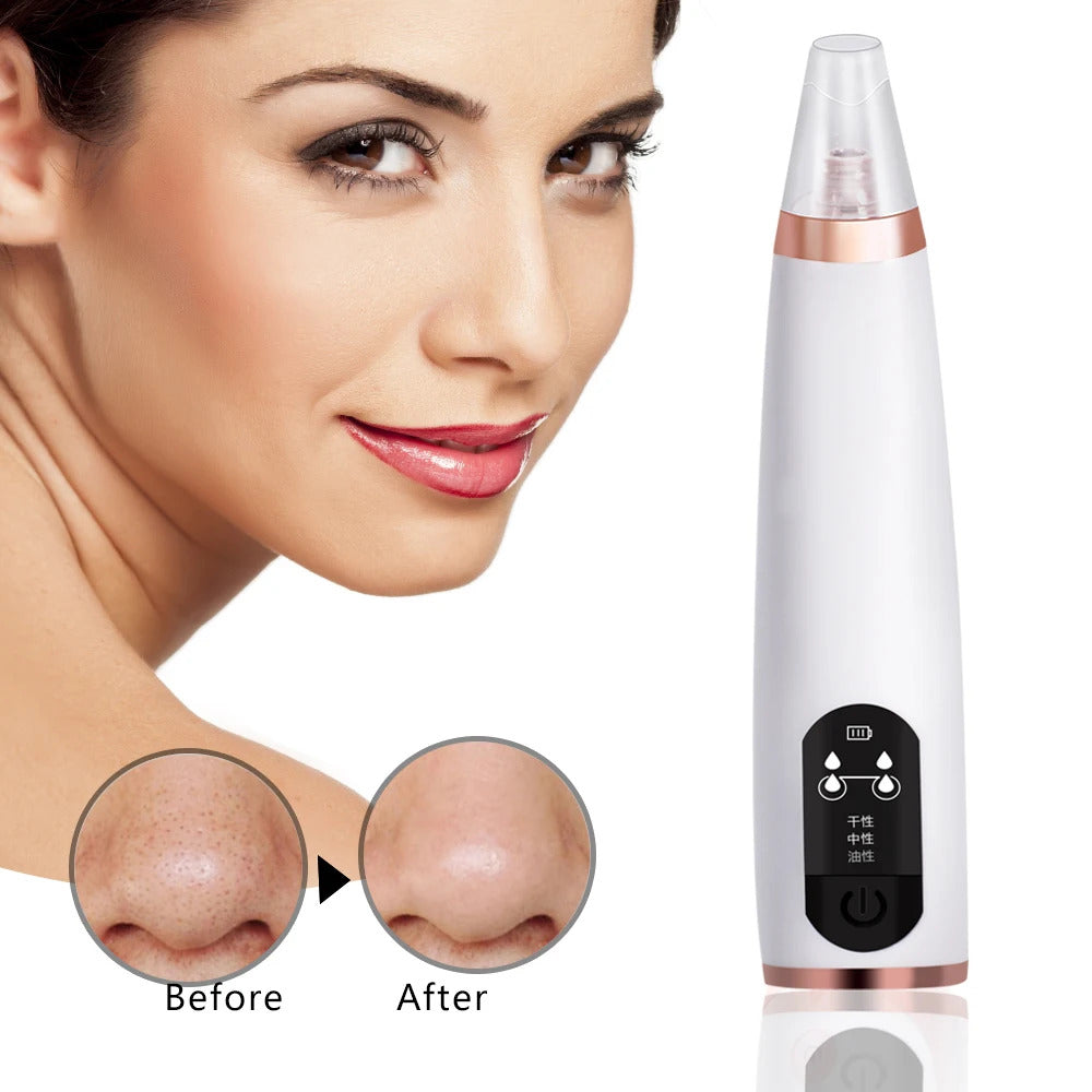 Powerful Electric Blackhead Remover for Home Use