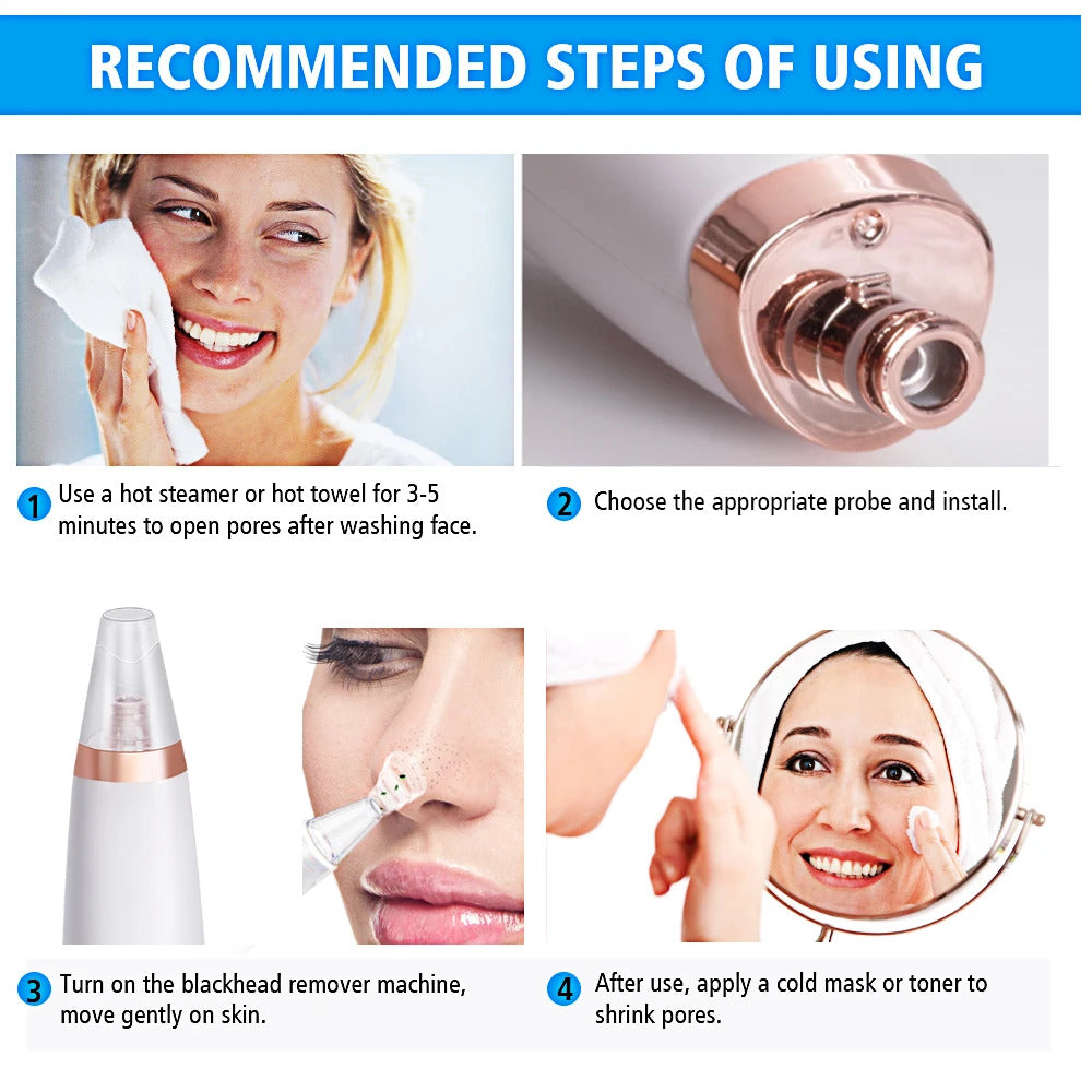 Powerful Electric Blackhead Remover for Home Use